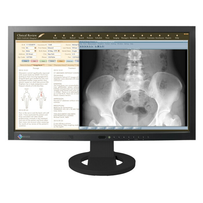 EIZO LED液晶モニター RadiForce MS230W 23.0インチワイド 縦型モニター ブラック 1980 x 1080 TFTパネル(VA) 業務用 医療用 ディスプレイポート DVI ディスプレイ ピボット 【中古】