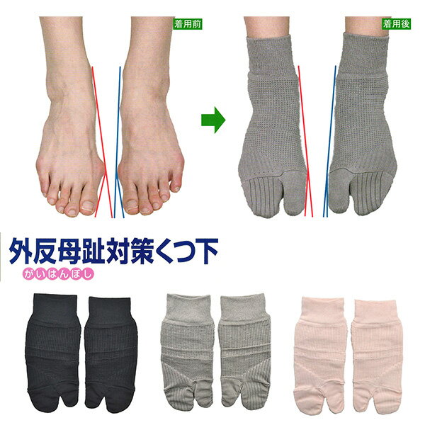 送料無料 外反母趾対策くつ下‐蘭華 コーポレーションパールスター 広島大学 外反母趾 予防 対策 矯正 くつ下 パット 綿 就寝時 長時間着用