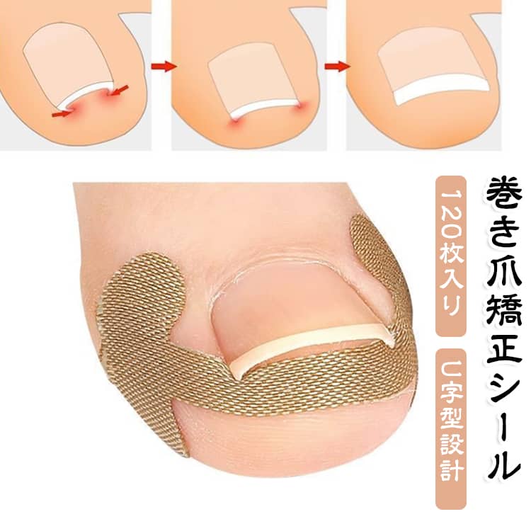 ネイルケア 巻き爪 シール 矯正 足の爪サポート 爪ケア 巻き爪ケア 巻き爪対策 貼るだけ簡単 約120枚入り シート フットケア用品 薄型設計 通気性あり 肌色 男女兼用 巻爪 巻き爪のテープ 巻き爪ブロック テープ 自宅ケア ケア用品