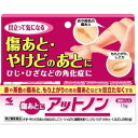 送料無料【第2類医薬品】アットノン 15gX3個+サービス品 傷あと・やけどのあとを改善