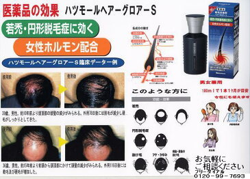 【メール便】【医薬部外品】ハツモ−ル・スカルプシャンプー 300ml育毛の環境 当店NO.1育毛シャンプー