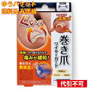 【ゆうパケット送料込み】巻き爪ワイヤーガード(4)