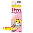 【第3類医薬品】 キンカン ハイハイローション 50ml 【セルフメディケーション税制対象】×12個