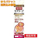 【ゆうパケット送料込み】浅井 巻爪用ケアテープ 20枚 携帯ケース付