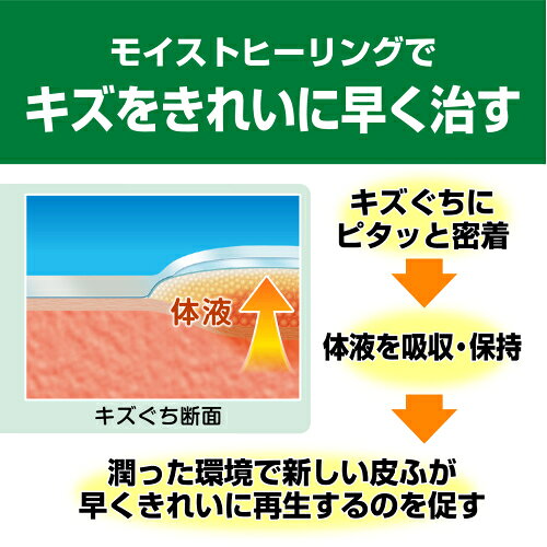 乐天商城 - ケアリーヴ 治す力 L 9枚入×10個