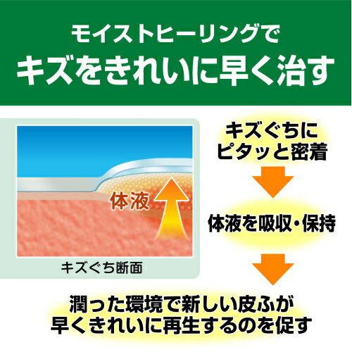 ケアリーヴ 治す力 ジャンボ 4枚入×10個