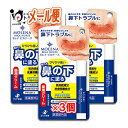 【医薬部外品】モレナ ビカナース 3.5g×3個セット【ゼリア新薬】鼻の下 乾燥 肌あれ 肌荒れ しもやけ ひび あかぎれ にきび ニキビ 剃刀負け カミソリ負け 防ぐ 塗り薬 皮膚 保護 クリーム 無香料 無着色 アルコールフリー スティックタイプ