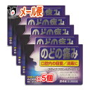 スカイブブロンAZトローチ 24錠×5個セットのどの炎症による痛み・はれを抑えます 口腔内の殺菌・消毒に 消炎剤 アズレンスルホン酸ナトリウム配合