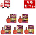 送料無料 5個セット【第2類医薬品】Vロート アクティブプレミアム (セルフメディケーション税制対象)(15ml)【ロート】 【代引不可】