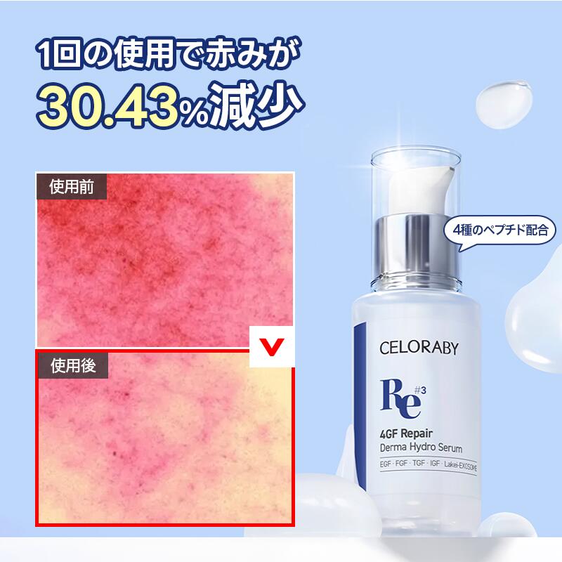 ★20%クーポン★ 4GFダーマセラム セロラバイ ナイアシンアミド・4種ペプチド・乳酸菌配合セラム 30ml/再生美容液/毛穴・乾燥・にきび跡・ニキビ予防/ハリ・トーンアップ・黒ずみ・インナードライケア