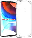 g[ Moto E7 Power P[X g e7 Power \tgP[X NX^ NA  TPUf یJo[ Moto e7 power 