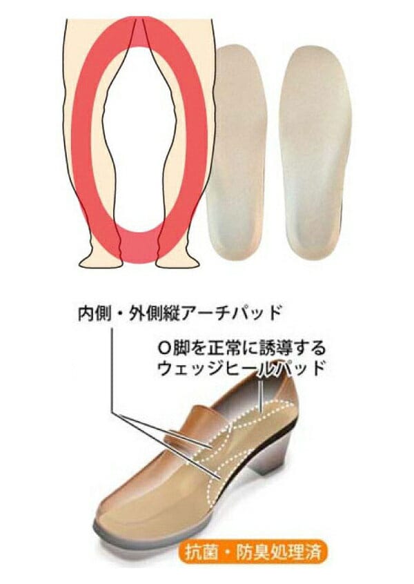 【メール便送料無料】村井 インソールプロ O脚対策 レディース 3