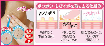 【あす楽】首 首イボ イボ ポロポロ いぼ イボ取り 除去 クリーム 角質粒 医薬部外品 薬用ピーリングスムーサーEX 25g 正規品 首イボ取りクリーム 首イボ の イボ を 取る