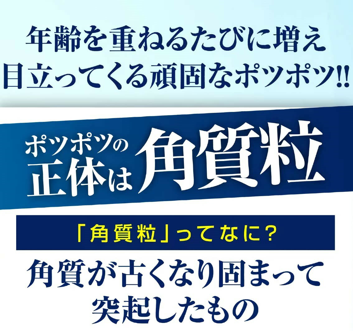 【セット】 イポケア EX 美容液 と ジェルパッチ の セット イボ取り イボ取りクリーム お肌 ポツポツ 角質ケア美容液 イボケア 角質粒 首イボ はとむぎ ヨクイニン 角質取り いぼ イボ 角質 首 皮膚 脇 顔 加齢 クリーム イボ取りクリーム いぼ イポケアEX 18mL 25g ibo