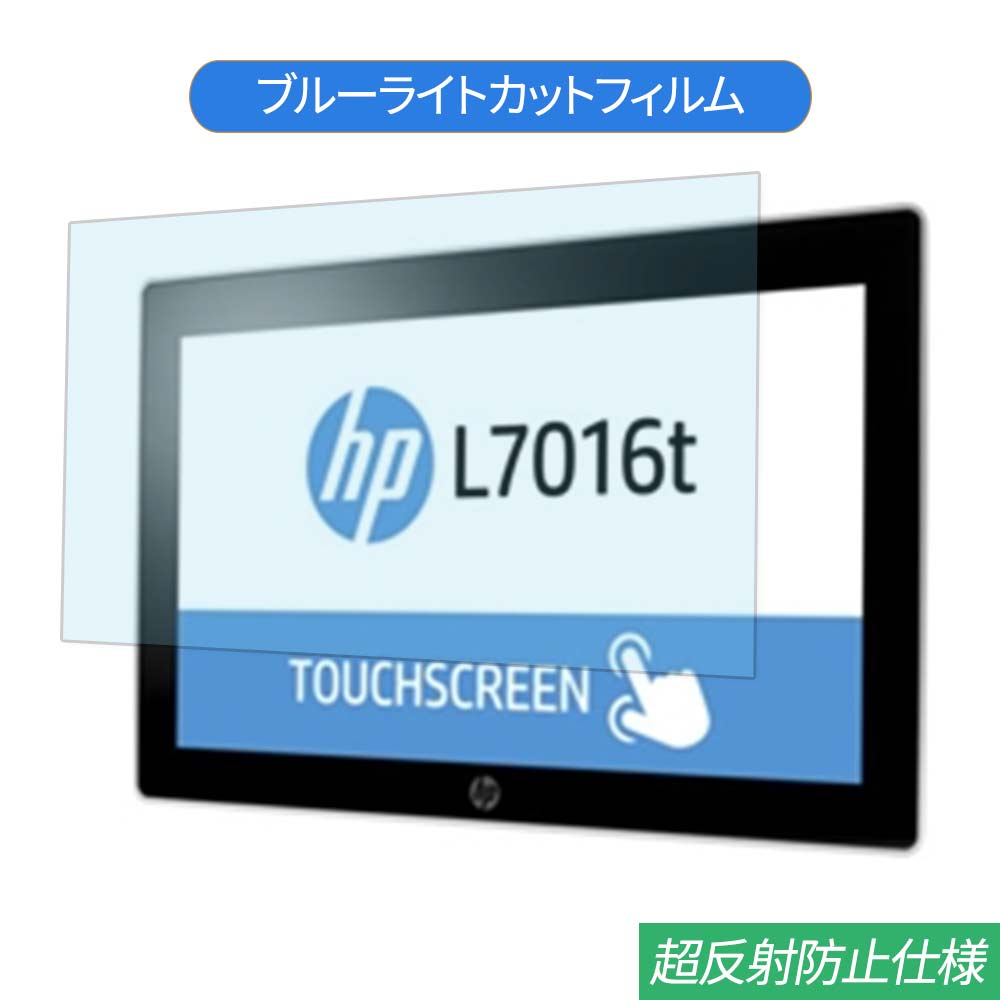 HP L7016t V1X13AA#AB4 15.6 б ֥롼饤ȥå ե վݸե ȿɻ 쥢