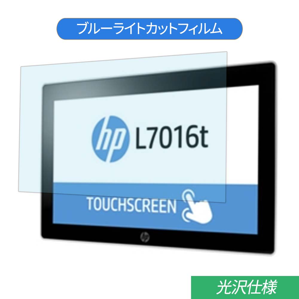 HP L7016t V1X13AA#AB4 15.6 б ֥롼饤ȥå ե վݸե 