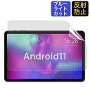 ALLDOCUBE iPlay40Pro / iPlay40H 10.4インチ タブレット用 フィルム ブルーライトカット 液晶 保護フィルム 反射低減