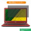 Acer Aspire ES1-332-H14D/RF 13.3 16:9  ɻ ץ饤Х ե륿 ֥롼饤ȥå ݸե ȿɻߥ֡Ǵ奷뼰