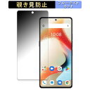 UMIDIGI A15 Pro 5G  y180xz `h~ tB u[CgJbg A`OA {