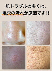 楽天市場 楽天1位 エステサロンのプロ監修 毛穴吸引器 美顔器 毛穴吸引 毛穴ケア 美顔 毛穴汚れ ほうれい線 角栓 黒ずみケア いちご鼻 イチゴ鼻 黒ずみ 除去 洗顔 小鼻 ニキビ 肌荒れ 頬 フェイスライン たるみ むくみ 改善 対策 角質 保湿 美顔 Liscia リーシャ 楽天市場 楽天1位 エステサロンのプロ監修 毛穴吸引器 美顔器 毛穴吸引 毛穴ケア 美顔 毛穴汚れ ほうれい線 角栓 黒ずみケア いちご鼻 イチゴ鼻 黒ずみ 除去 洗顔 小鼻 ニキビ 肌荒れ 頬 フェイスライン たるみ むくみ 改善 対策 角質 保湿 美顔 Liscia リーシャ