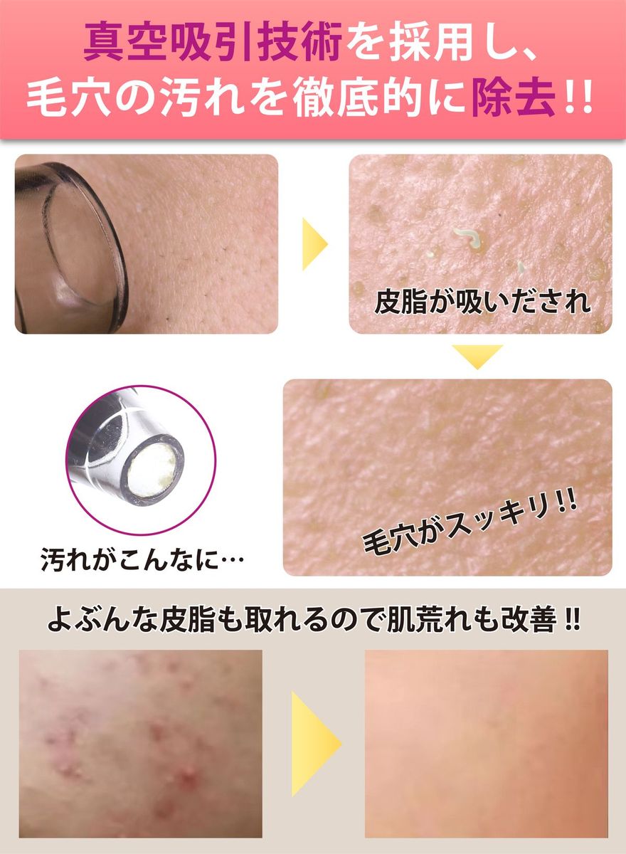 楽天市場 楽天1位 エステサロンのプロ監修 毛穴吸引器 美顔器 毛穴吸引 毛穴ケア 美顔 毛穴汚れ ほうれい線 角栓 黒ずみケア いちご鼻 イチゴ鼻 黒ずみ 除去 洗顔 小鼻 ニキビ 肌荒れ 頬 フェイスライン たるみ むくみ 改善 対策 角質 保湿 美顔 Liscia リーシャ