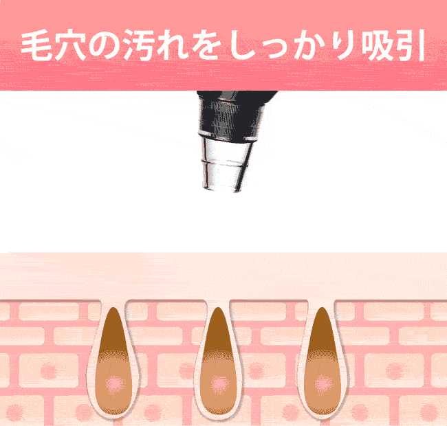 【エステサロンのプロ監修】毛穴吸引器美顔器毛穴吸引毛穴ケア美顔毛穴汚れほうれい線角栓黒ずみケアいちご鼻イチゴ鼻黒ずみ除去洗顔小鼻ニキビ肌荒れ頬フェイスラインたるみむくみ改善対策角質保湿美顔