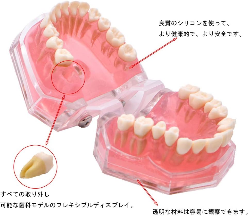 ライフスタイルメイト楽天市場店の歯列模型 歯が抜く説明モデル 説明モデル 教学モデル 歯科インプラントモデル 研究治療説明用 父の日 取り外し可能 上下顎模型｜アングル2