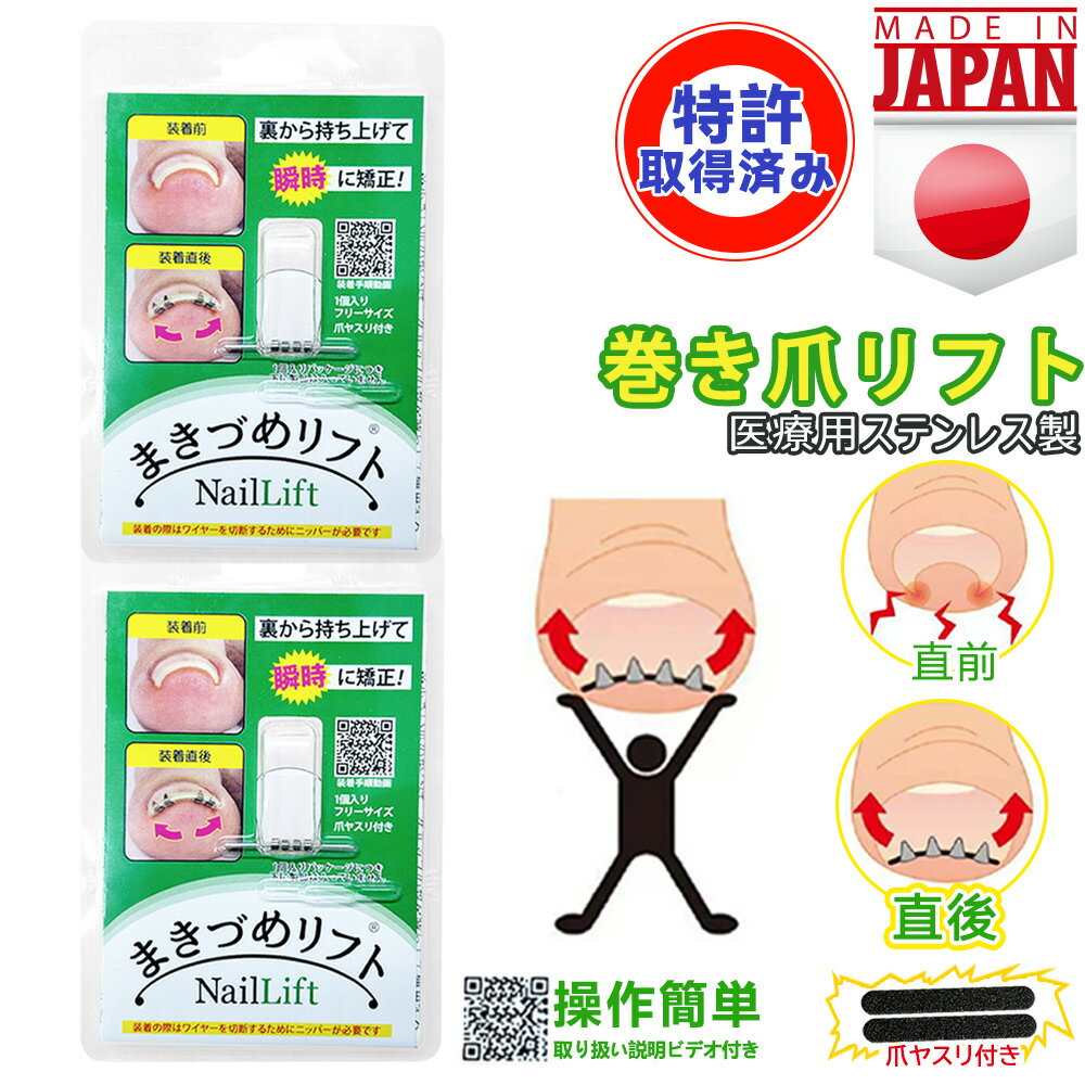 【日本製は信頼できます!】【当日出荷】巻き爪用クリップ 巻きづめ 親指 お手入れ ケア つめ ネイル クリップ ワイヤー ガード 爪ブロック 切り方 テープ ロボ 巻きづめ 靴 巻爪 対策 巻き爪 自宅 グッズ 巻き爪 自分で ブロック テープ 介護自宅 ワイヤー 巻き爪 自分で