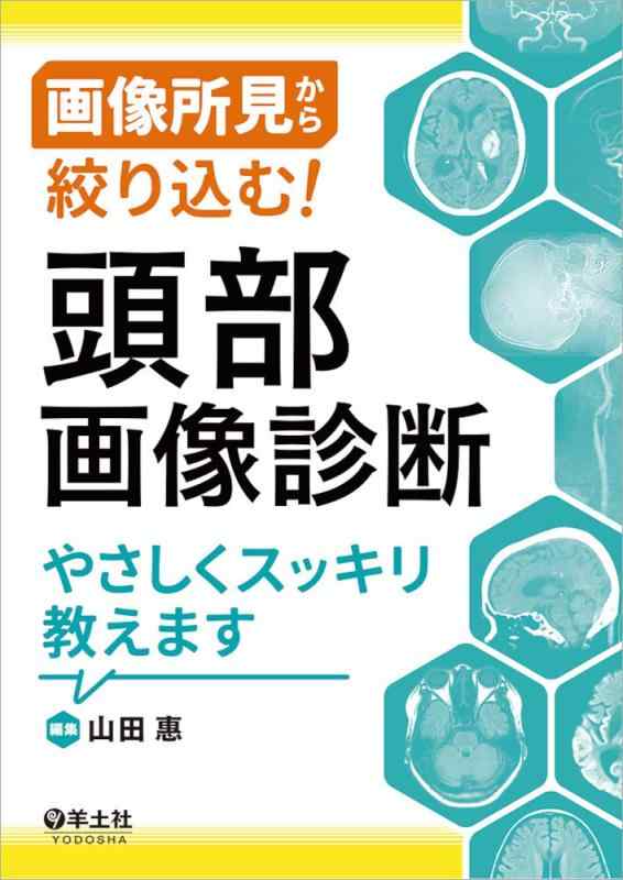 【中古】画像所見から絞り込む 頭部画像診断やさしくスッキリ教えます