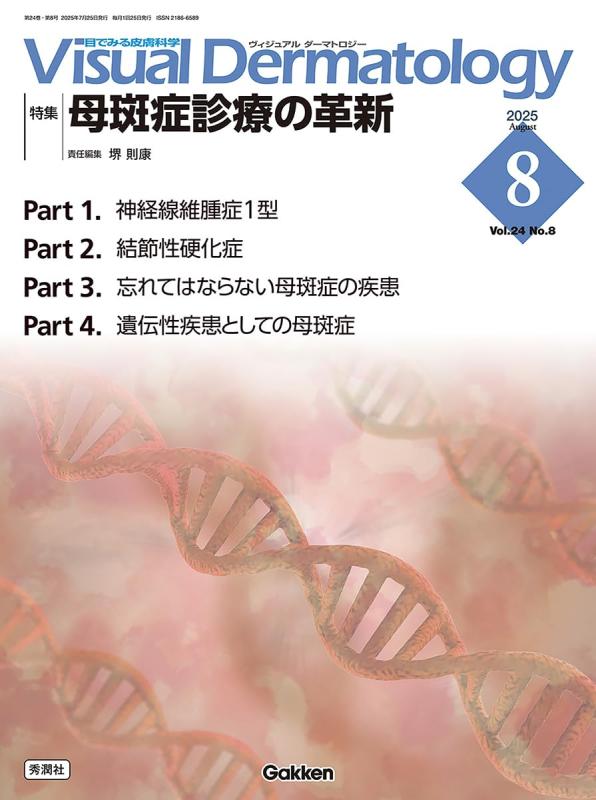 Visual D. 2025年8月号 Vol.24 No.8: 母斑症診療の革新 (Visual Dermatology)