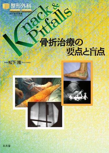骨折治療の要点と盲点 (整形外科knack &amp; pitfalls)