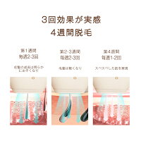 beautigo2020新型脱毛器即時に配送全身VIOレーザー脱毛器iplヒゲ脱毛シェーバープロレベルのムダ毛処理脱毛器おすすめ自宅でフラッシュ脱毛50万発脱毛器父の日プレゼント