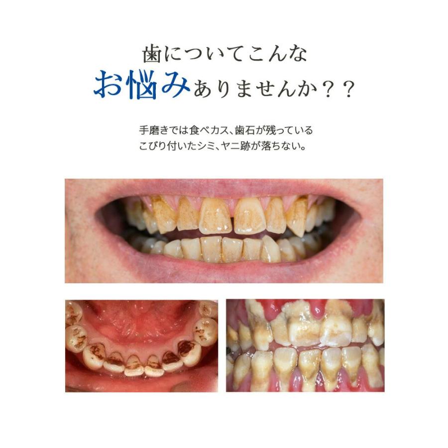 口腔洗浄器 超音波 電動歯ブラシ 歯石取り 口腔ケア IPX7防水 5段モード 口臭防止 ...