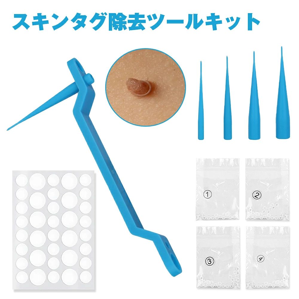 ★イボ除去 スキンタグ除去デバイスキット イボ取り スキンタグ イボ取り イボケア イボ スキンタグ除去ツールキット ほくろいぼリムーバーパッチ 小型から大型のスキンタグ用のスキンタグリムーバーツール 全身適応