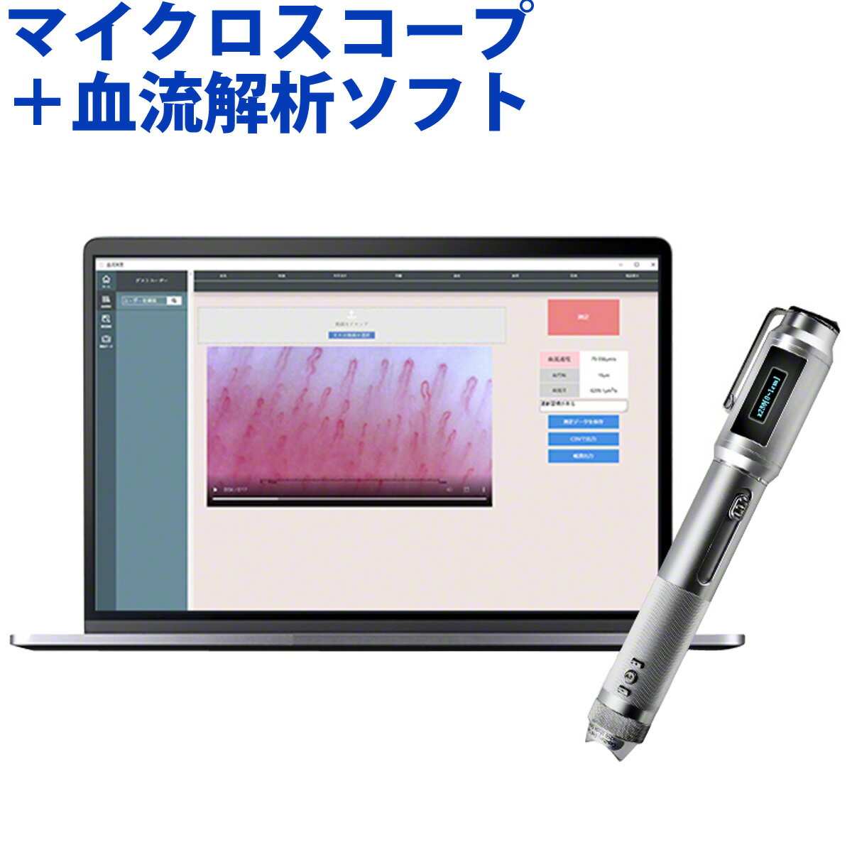 顕微鏡 頭皮 肌 指用血流観察オートフォーカスマイクロスコープ VIEWTY 血流解析ソフト Viewty Eva ビューティー エヴァ