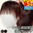 【8/15限定 ポイント5倍】 部分ウィッグ トップカバー 増毛かつら トップウィッグ カバーピース ヘアピース かつら 男性 女性 ウイッグ メンズ レディース トップピース ポイントピース 白髪隠し 痛くない 医療用 部分カツラ つむじ 頭頂部 人毛 ショート ヘアーピース