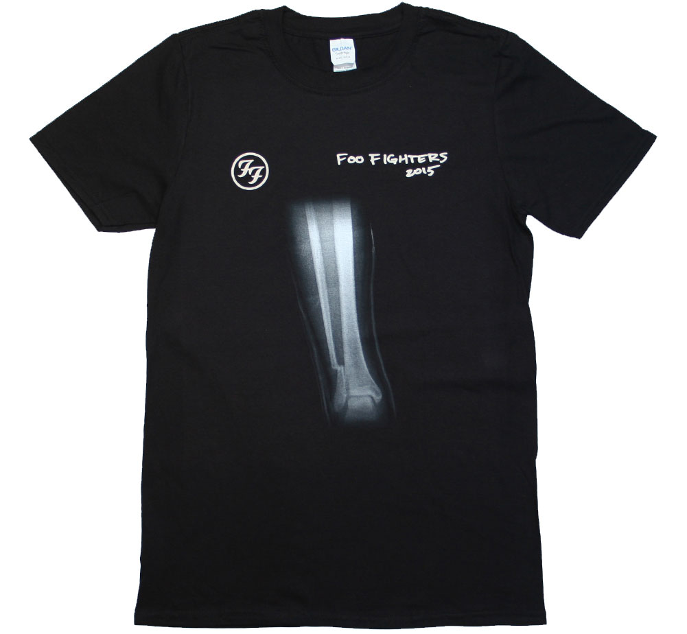 Foo Fighters / Broken Leg Tee (Black) - フー ファイターズ Tシャツ