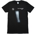 Foo Fighters / Broken Leg Tee (Black) - フー ファイターズ Tシャツ