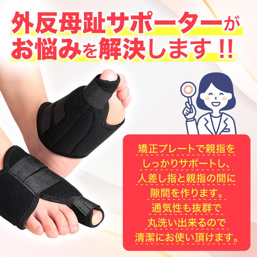 MAGN楽天市場店の外反母趾 サポーター 親指 足指 矯正つま先 広げる 痛い 左右セット｜アングル3