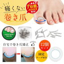 巻き爪 矯正 巻き爪チェーン 爪ワイヤー テープ付き 12個 矯正器具 爪切り ネイルエイド セルフケア サポーター(4)