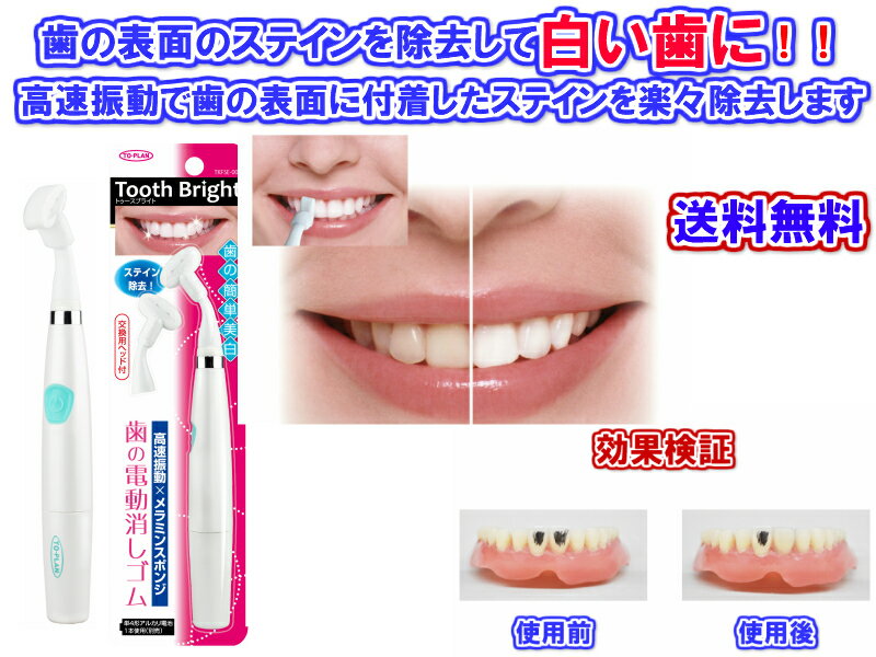 【歯の表面に付着したステインを除去】歯の電動消しゴムTooth Bright(トゥースブライト）【送料無料・即日発送】【メール便対応】[歯を白くする　歯垢　取り除く　除去　ステイン　ヤニ　ニコチンタール　　タバコ　たばこ　煙草　]