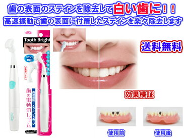 【歯の表面に付着したステインを除去】歯の電動消しゴムTooth Bright(トゥースブライト）【送料無料・即日発送】【メール便対応】[歯を白くする　歯垢　取り除く　除去　ステイン　ヤニ　ニコチンタール　コーヒー　ホワイトニング　歯の黄ばみ　タバコ　たばこ　煙草　]