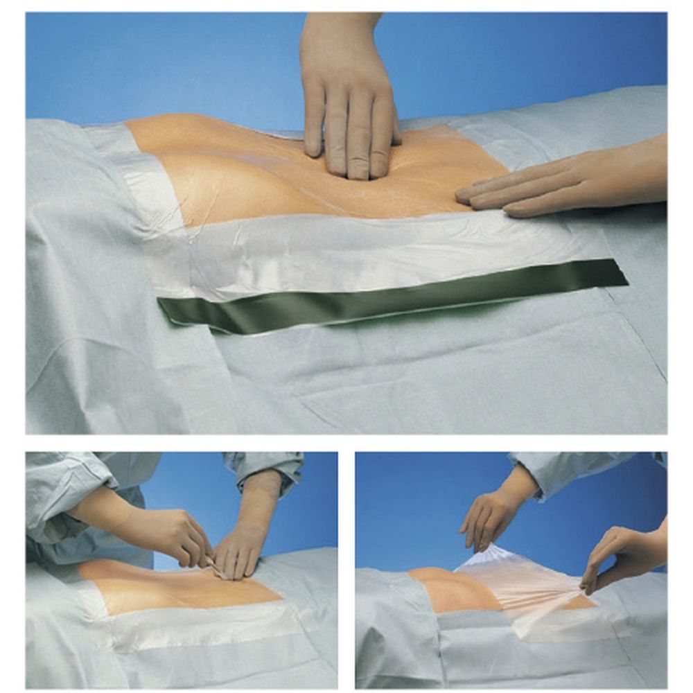 バリアー インサイズドレープ4040 804040（40X40CM）80マイ 1箱 メンリッケヘルスケア 24-5426-02