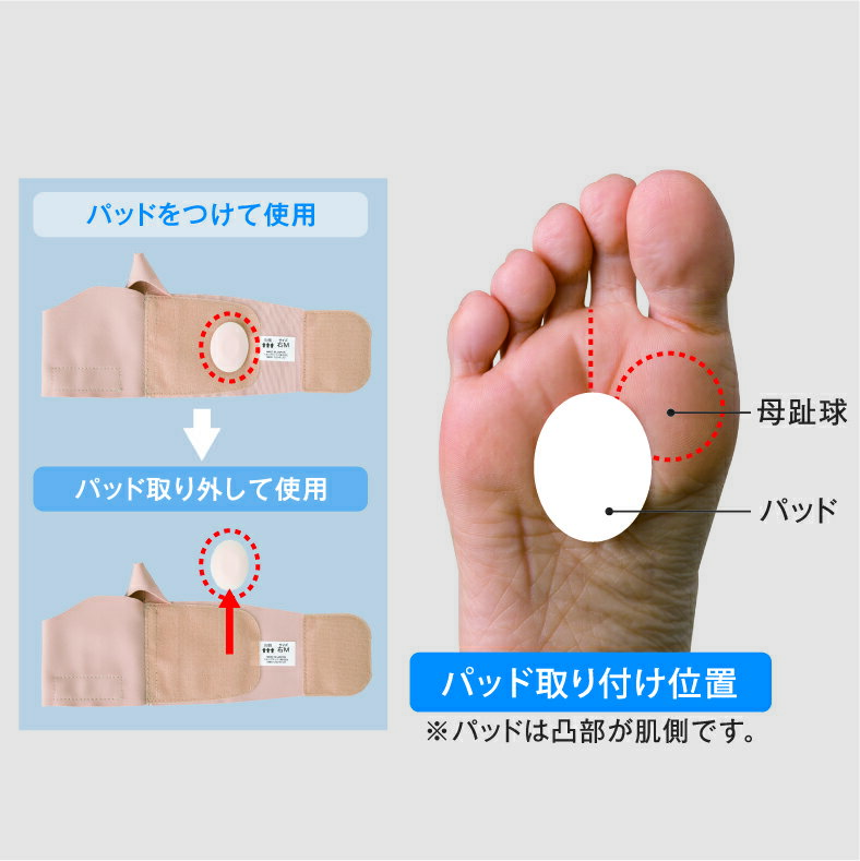 ファシリエイドサポーター　外反母趾　左S　303611