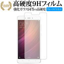 Xiaomi Redmi Note 4/xiaomi p  KXtB   dx9H u[CgJbg ^Cv  tیtB Lۏؕt