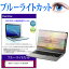 ASUS Vivobook 15 M1502YA [15.6] ݸ ե С  ֥롼饤ȥå  վݸեͭݾդ