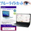 Acer Aspire R3-131T [11.6] ֥롼饤ȥå վݸե վС վ ͭݾդ