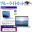 APPLE MacBook Air Retinaǥץ쥤 1600/13.3 MREC2J/A [13.3] ǻȤ ֥롼饤ȥå վݸե վС վ ͭݾդ