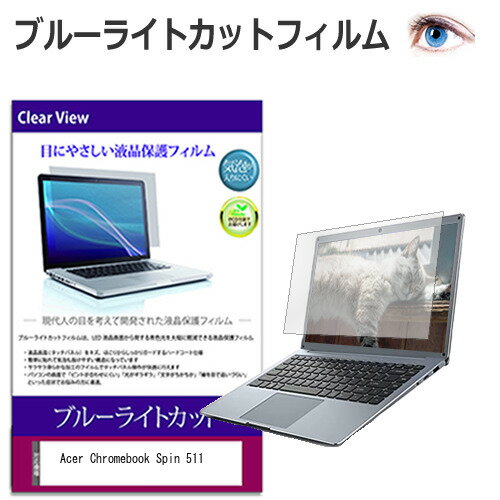 Acer Chromebook ֥å Spin 511 [11.6] ǻȤ ֥롼饤ȥå վݸե վС վ ͭݾդ