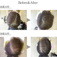 ふんわり女髪美トリートメント1000ml詰替え用リンス薄毛予防ハリコシボリューム発毛促進細胞賦活血流促進女性レディースプレゼント頭皮ボタニカルキレイ潤い